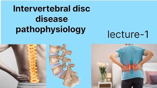 Inter vertebral disc disease IVDD hindi main IVDD pathophysiology [upl. by Shannon88]