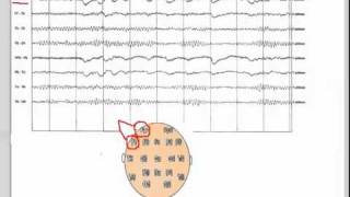 EEG  101 [upl. by Alac369]