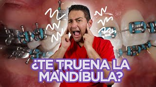 😖 ”ME TRUENA LA MANDÍBULA” 😖 ¡DEBERÍAS VER ESTE VIDEO😍 🔥CASO de CHASQUIDOS RESUELTO en 2021🔥 [upl. by Alejandrina336]