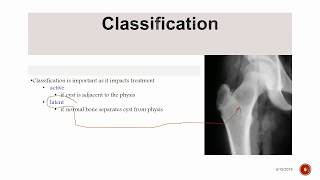 Unicameral Bone Cyst [upl. by Aliahkim]