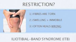 Iliotibial Band Syndrome ITB [upl. by Carlyn]