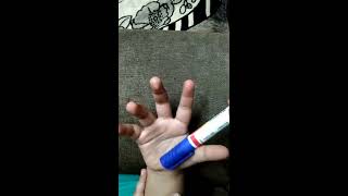 Pen Test  Median Nerve  How to do the pen test  Abductor policis brevis  abduction of thumb [upl. by Chantal]