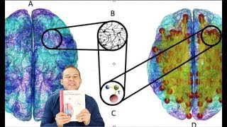 The Brain Connectome Explained Through Graph Theory Neurofeedback Implications [upl. by Walliw]