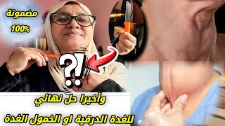 أقوى طريقة علاج الخمول الغدة الدرقية في البيت بدون عمليات جراحية أعراض الغدة الدرقية وكيفية علاجها [upl. by Regni]