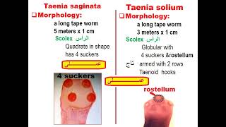 Taenia saginata amp Taenia solium [upl. by Leal]