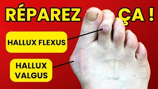 Top 3 Fixes For Foot Pain 1 translated [upl. by Taber728]