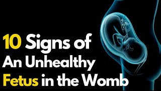 10 Signs of an Unhealthy Fetus  Symptoms of Unhealthy Baby During Pregnancy [upl. by Hennessey]