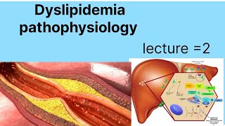 Pathophysiology of hyper dyslipidemia  dyslipidemia types and causes  hypercholesteolemia [upl. by Ahsitahs]