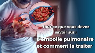 Lembolie pulmonaire  un risque fréquent mais souvent méconnu Voici comment se protéger [upl. by Auqinal]