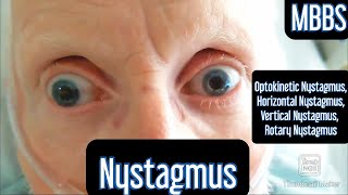 Nystagmus Optokinetic Horizontal Vertical Rotary mbbs medicine neetpg usmle [upl. by Weinshienk264]