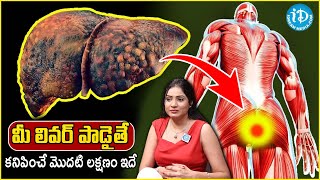 10 Symptoms of Liver Problem  Fatty Liver Symptoms  liver damage  Dr Abitha Chilukuri  iDream [upl. by Leacock]