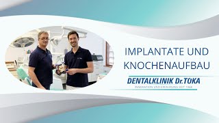 Implantate und Knochenaufbau Erklärvideo Dentalklinik Dr Tóka in SopronUngarn [upl. by Roe866]