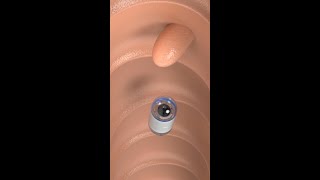 Capsule Endoscopy science shorts medicine [upl. by Deyes928]