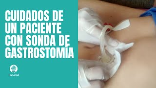 Cuidados de paciente con sonda de gastrostomía [upl. by Guimond327]