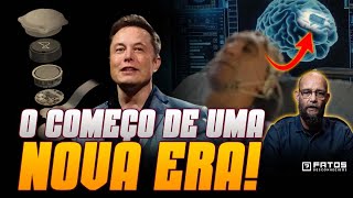 Urgente Elon Musk implanta chip no cérebro do primeiro humano [upl. by Rowell]