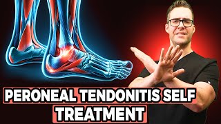 Peroneal Tendonitis Self Treatment Stretches Exercises amp Massage [upl. by Hrutkay387]