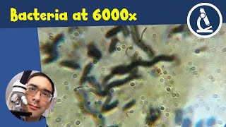 🔬 How to upgrade your microscope to get a 6000x magnification  Amateur Microscopy [upl. by Areyk]