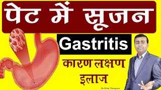 पेट में सूजन gastritis कारण लक्षण इलाज।gastritis in hindi [upl. by Vince]