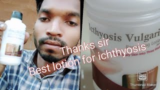 Icthyosis vulgaris removing lotion bhupendra gamit Gujarat [upl. by Airdnahs]