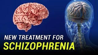 New Treatment for Schizophrenia [upl. by Woodman]