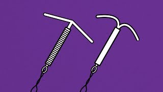 Brook Contraception  IUD and IUS Animation [upl. by Semreh]