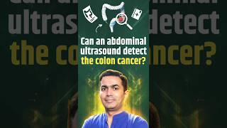 Can an abdominal ultrasound detect the colon cancer [upl. by Michael]