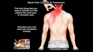 Neck Pain Causes and Treatment  Everything You Need To Know  Dr Nabil Ebraheim [upl. by Warenne496]