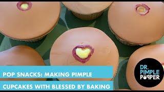 POP SNACKS Making Pimple Cupcakes with Dr Pimple Popper amp Blessed By Baking [upl. by Lexine]