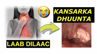 LAAB DILAACA🔥Sababaha Calaamadaha Daawadadhibaatooyin ka dhalan kara lab dilaaca [upl. by Akieluz]