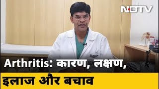 What Causes Rheumatoid Arthritis  क्या होता है गठ‍िया  आर्थराइटिस के कारण लक्षण इलाज और बचाव [upl. by Aerdnuahs]