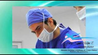 Abdominoplastia  Video [upl. by Enirahtac]