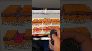 Loving how this Anki controller has streamlined my studying ankiremote medschool ankiclicker [upl. by Bergren]