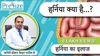 हर्निया क्या है  हर्निया का इलाज  What is Hernia in Hindi  Hernia Treatment [upl. by Amberly]