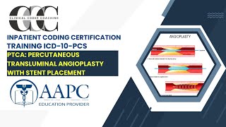 ICD 10 PCS PTCA and STENT [upl. by Onairot]