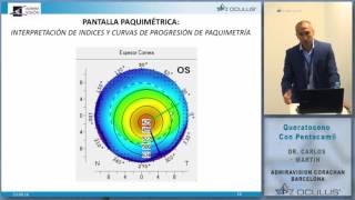 DR CARLOS MARTÍN CALVO QUERATOCONOS CON PENTACAM [upl. by Cardwell]