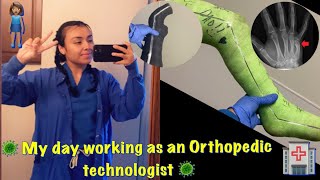 WORK LIFE AS AN ORTHOPEDIC TECHNOLOGIST ULNAR GUTTER CAST REMOVAL [upl. by Ainesej]