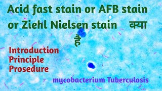 acid fast staining procedure and principle in Hindi  ZN stain  AFB stain [upl. by Goldman942]