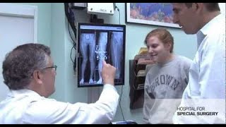 Knock Knee Correction Surgery Helps High School Athlete Get Back in the Game [upl. by Eanel]