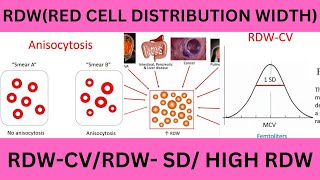 RDWRED CELL DISTRIBUTION WIDTH RDW SDRDW CVNORMAL RANGESHIGH RDWRDW AND ANEAMIA RDW FORMULA [upl. by Reggy]