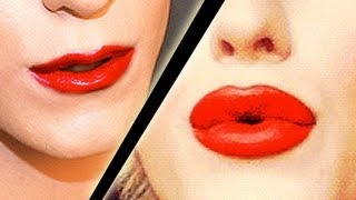 My Lip Injections Before amp After  Gigi [upl. by Nilam]