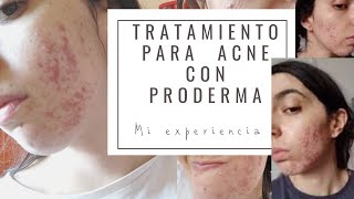 Mi experiencia con PRODERMA  tratamiento acné [upl. by Festatus37]