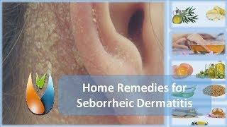 Home Remedies for Seborrheic Dermatitis [upl. by Imotas918]