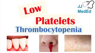 Thrombocytopenia  Signs and Symptoms and Approach to Causes [upl. by Inneg]