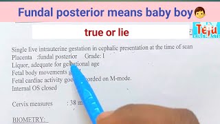 fundal posterior placenta means baby boybaby gender with placentaAmmateju [upl. by Davey]