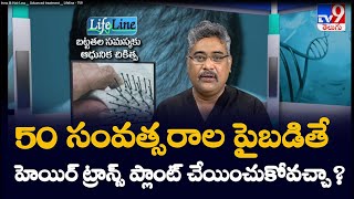 50 సంవత్సరాల పైబడితే హెయిర్ ట్రాన్స్ ప్లాంట్ చేయించుకోవచ్చా [upl. by Meedan]