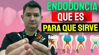 Que es la Endodoncia [upl. by Airelav97]