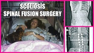 Stephanies Scoliosis Surgery Story  Stephanie Kaye [upl. by Burroughs]