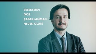 Bebeklerde göz çapaklanması  DoçDrHalil Hüseyin Çağatay [upl. by Warenne]