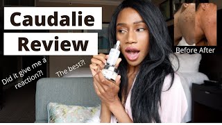 Caudalie Vinoperfect Radiance Dark Spot Serum and Moisturizer with Niacinamide Review  Regina Ramos [upl. by Allerbag]