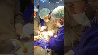 Esophagectomy largest operation anesthesia doctor shorts [upl. by Kiel30]